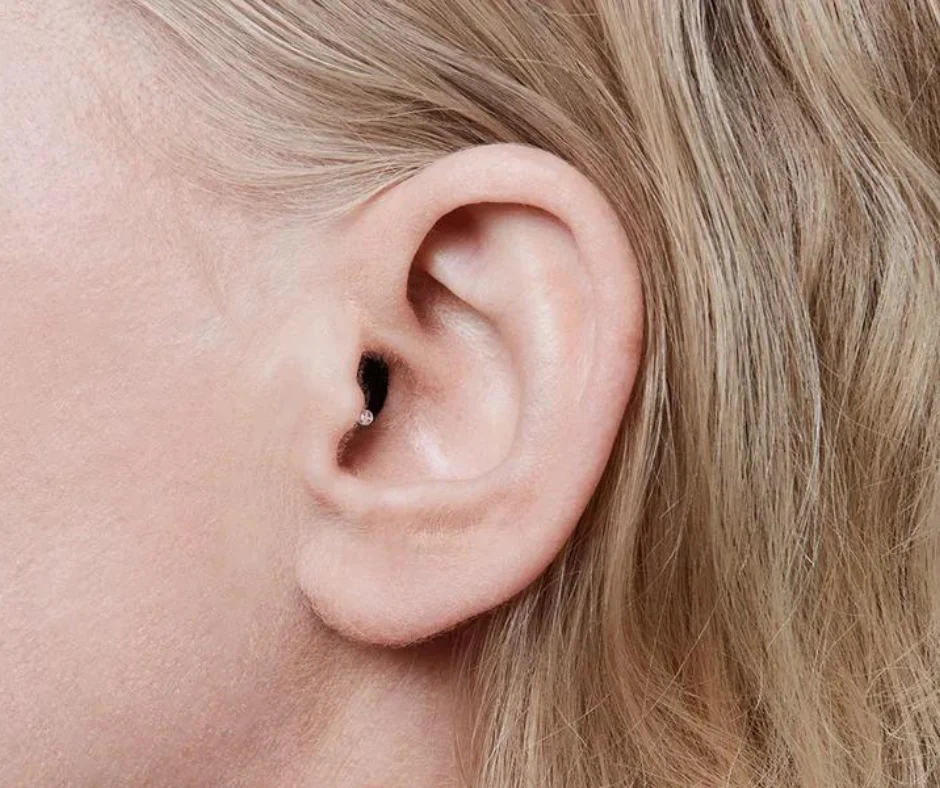 IIC hearing aid in womans ear