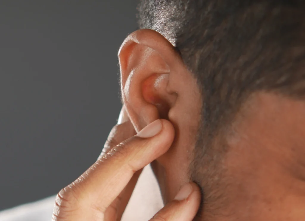 Single sided deafness